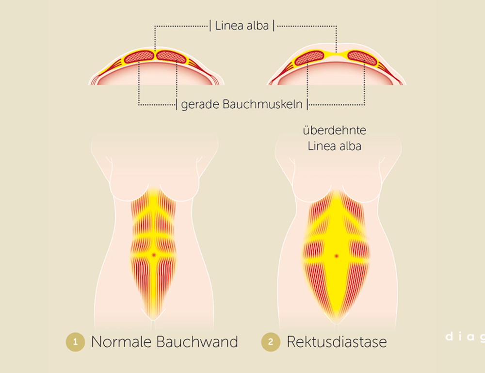 Diagnosesendung