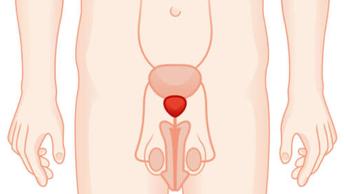 Prostata large