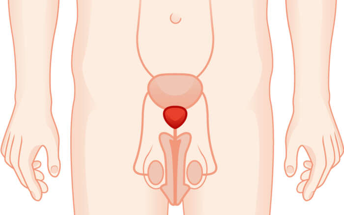 Prostata large