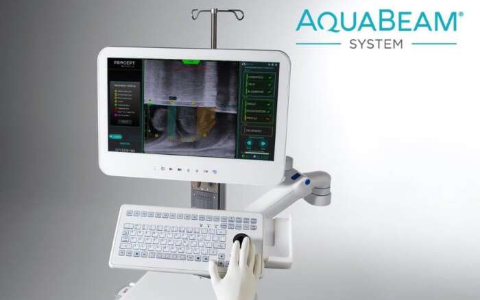 Aquabeam system